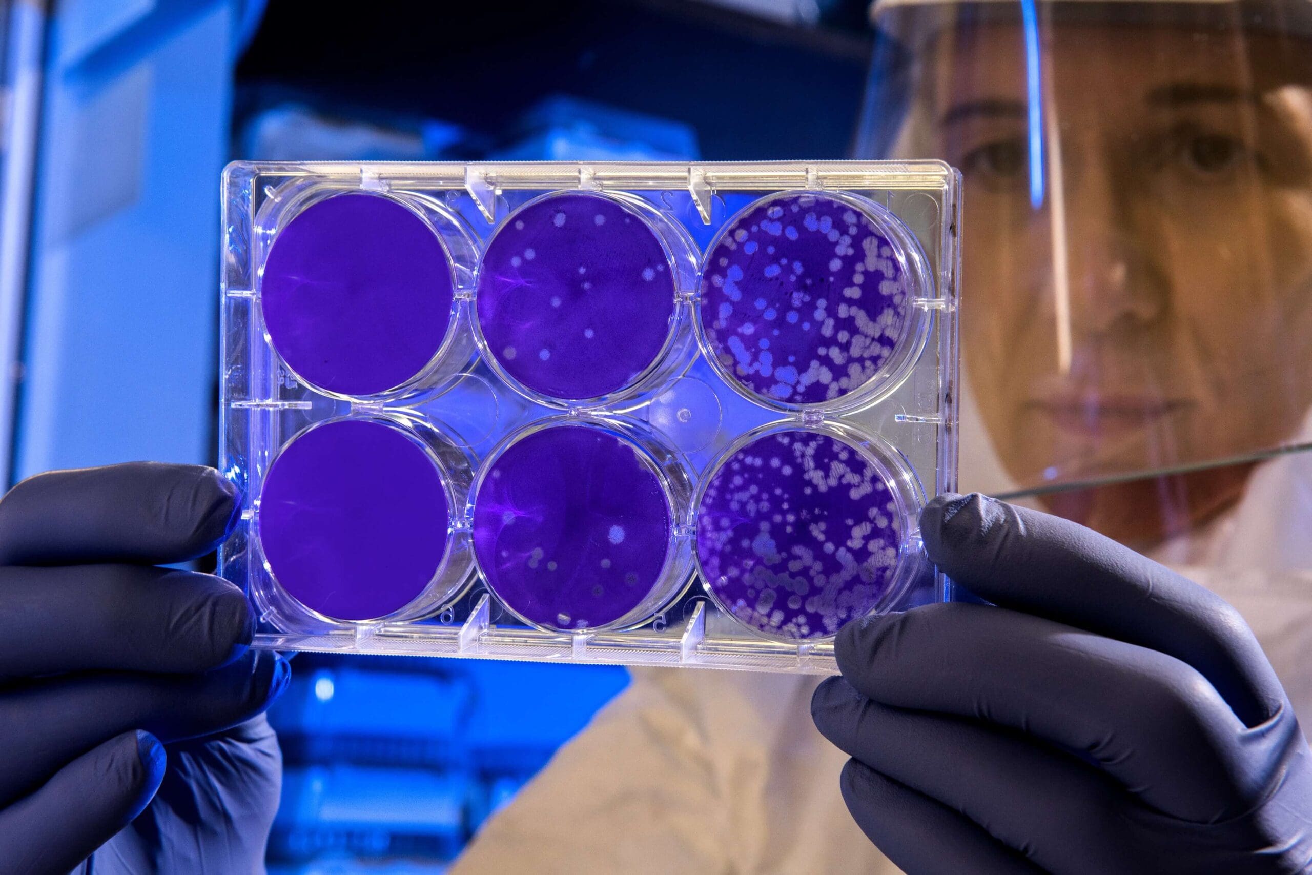 Cientista observando materiais de teste. (Foto por CDC no Unsplash)